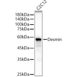 Western Blot - Anti-Desmin Antibody (A89616) - Antibodies.com