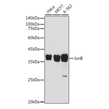 Western Blot - Anti-JunB Antibody (A89617) - Antibodies.com