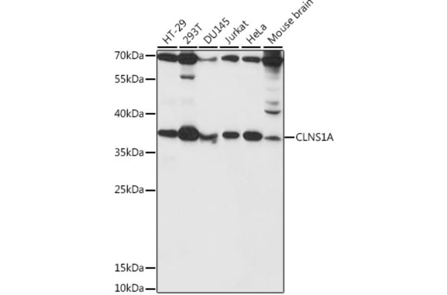 Western Blot - Anti-CLNS1A/CLCI Antibody (A89618) - Antibodies.com