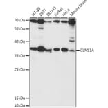 Western Blot - Anti-CLNS1A/CLCI Antibody (A89618) - Antibodies.com
