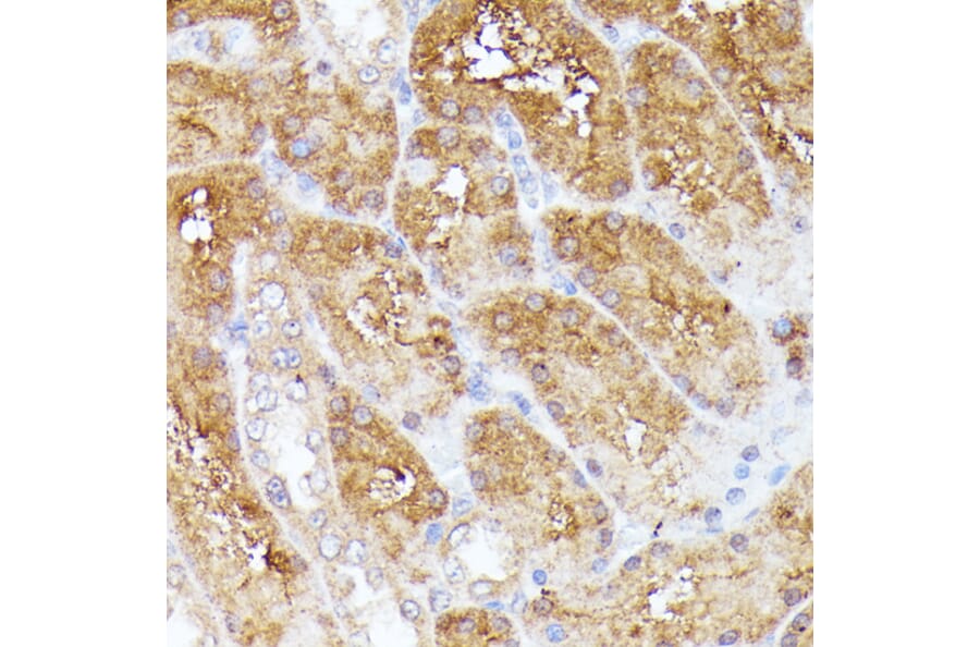 Immunohistochemistry - Anti-CLNS1A/CLCI Antibody (A89618) - Antibodies.com
