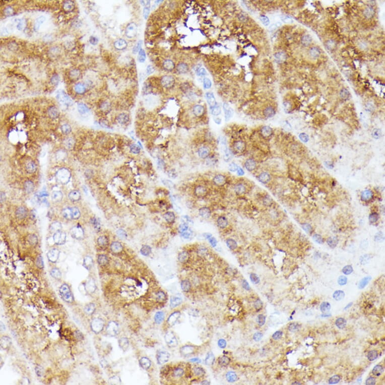 Immunohistochemistry - Anti-CLNS1A/CLCI Antibody (A89618) - Antibodies.com