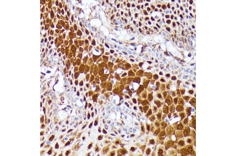 Immunohistochemistry - Anti-CLNS1A/CLCI Antibody (A89618) - Antibodies.com