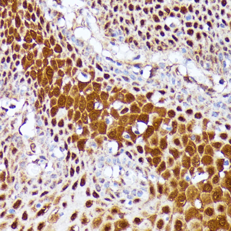 Immunohistochemistry - Anti-CLNS1A/CLCI Antibody (A89618) - Antibodies.com