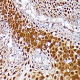 Immunohistochemistry - Anti-CLNS1A/CLCI Antibody (A89618) - Antibodies.com