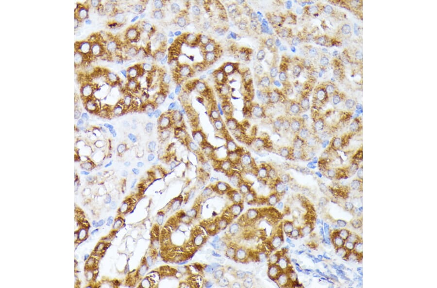 Immunohistochemistry - Anti-CLNS1A/CLCI Antibody (A89618) - Antibodies.com