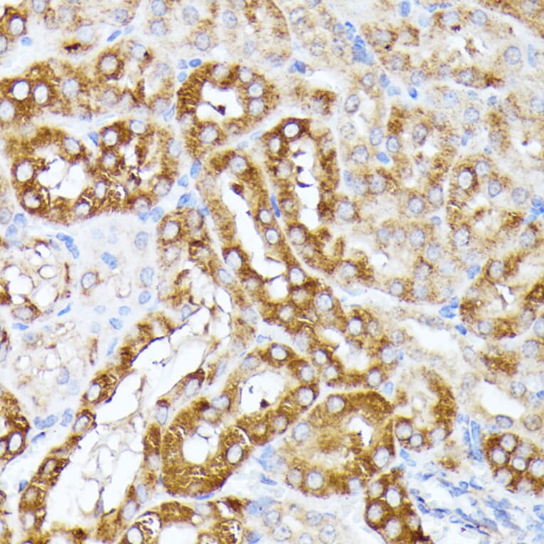Immunohistochemistry - Anti-CLNS1A/CLCI Antibody (A89618) - Antibodies.com