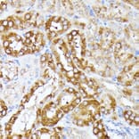 Immunohistochemistry - Anti-CLNS1A/CLCI Antibody (A89618) - Antibodies.com