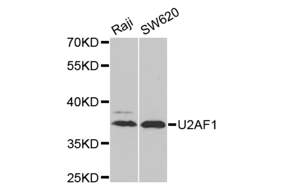 Western Blot - Anti-U2AF1 Antibody (A6076) - Antibodies.com