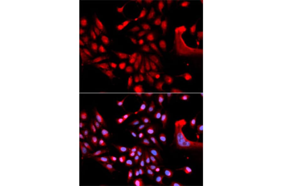 Immunofluorescence - Anti-U2AF1 Antibody (A6076) - Antibodies.com
