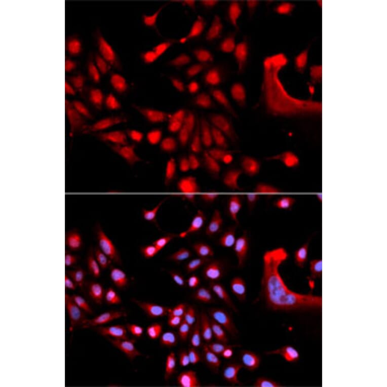 Immunofluorescence - Anti-U2AF1 Antibody (A6076) - Antibodies.com