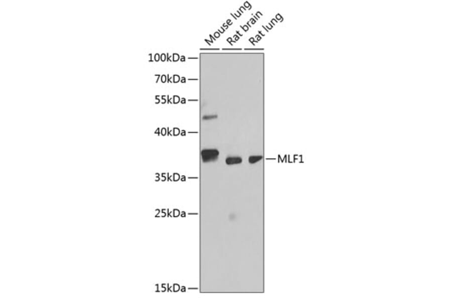 Western Blot - Anti-Myeloid leukemia factor 1 Antibody (A89620) - Antibodies.com