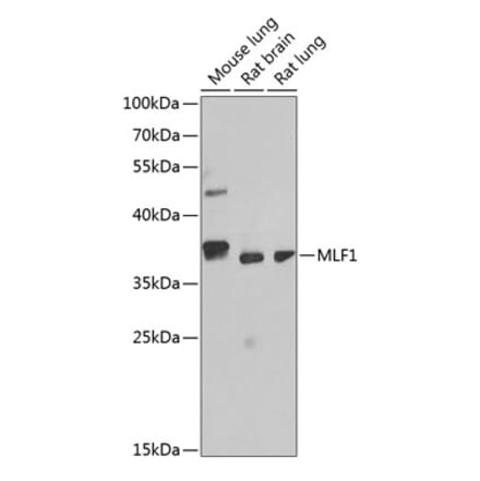 Western Blot - Anti-Myeloid leukemia factor 1 Antibody (A89620) - Antibodies.com