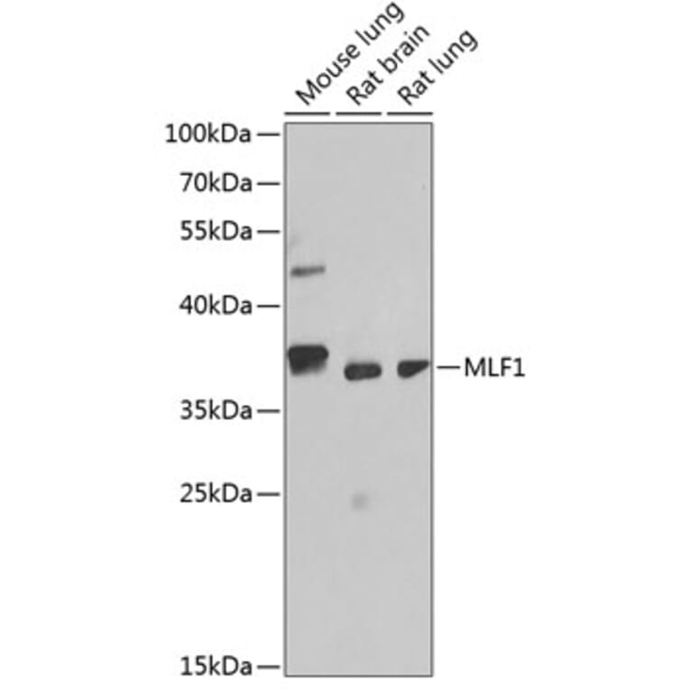 Western Blot - Anti-Myeloid leukemia factor 1 Antibody (A89620) - Antibodies.com