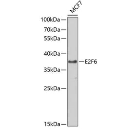 Western Blot - Anti-E2F6 Antibody (A89621) - Antibodies.com