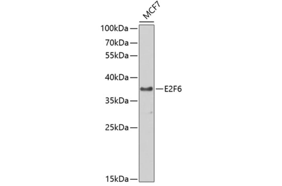 Western Blot - Anti-E2F6 Antibody (A89621) - Antibodies.com