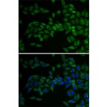 Immunofluorescence - Anti-E2F6 Antibody (A89621) - Antibodies.com