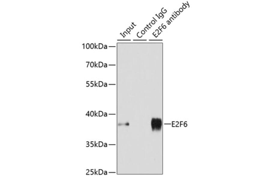 Western Blot - Anti-E2F6 Antibody (A89621) - Antibodies.com