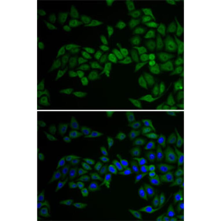 Chromatin Immunoprecipitation - Anti-E2F6 Antibody (A89621) - Antibodies.com