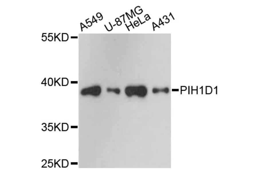 Western Blot - Anti-PIH1D1 Antibody (A13718) - Antibodies.com