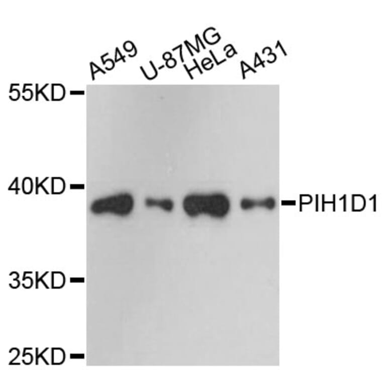 Western Blot - Anti-PIH1D1 Antibody (A13718) - Antibodies.com