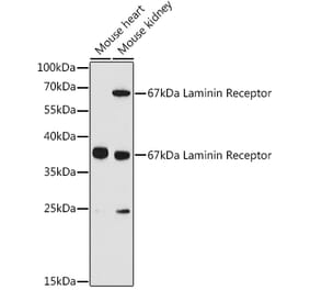 Western Blot - Anti-67kDa Laminin Receptor Antibody (A89623) - Antibodies.com