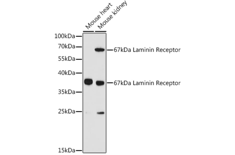 Western Blot - Anti-67kDa Laminin Receptor Antibody (A89623) - Antibodies.com