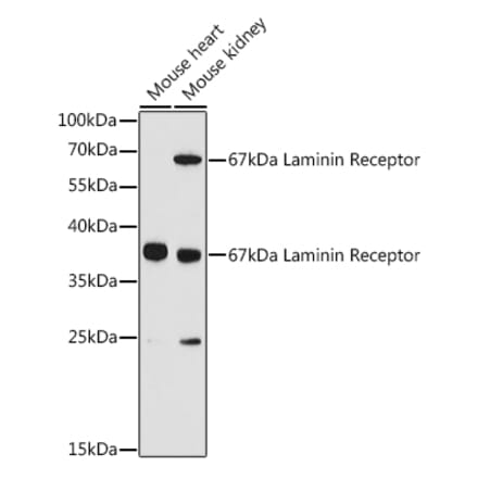 Western Blot - Anti-67kDa Laminin Receptor Antibody (A89623) - Antibodies.com