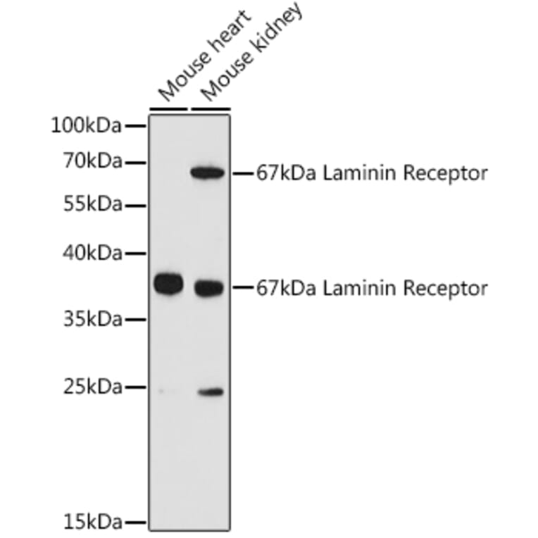 Western Blot - Anti-67kDa Laminin Receptor Antibody (A89623) - Antibodies.com