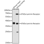 Western Blot - Anti-67kDa Laminin Receptor Antibody (A89623) - Antibodies.com
