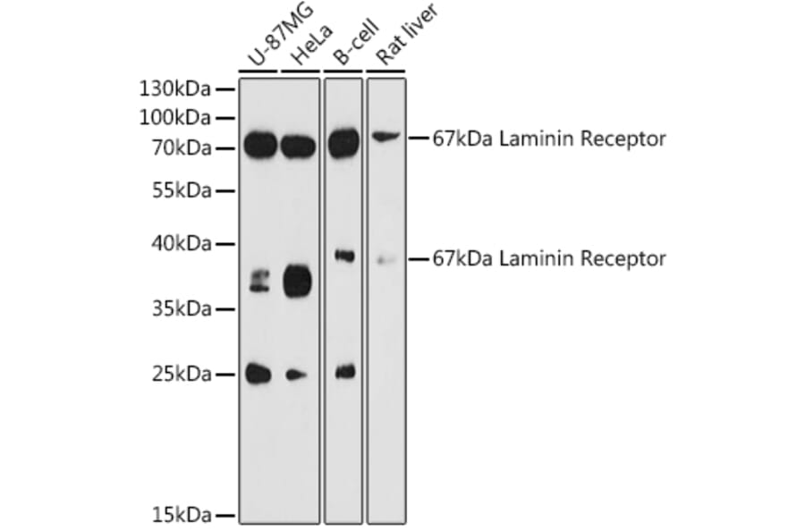 Western Blot - Anti-67kDa Laminin Receptor Antibody (A89623) - Antibodies.com