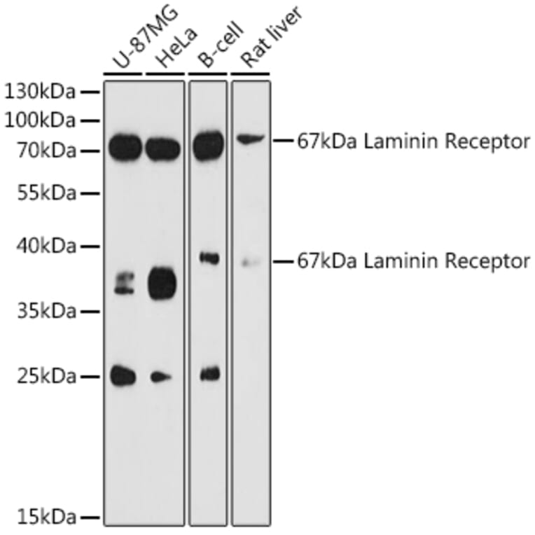 Western Blot - Anti-67kDa Laminin Receptor Antibody (A89623) - Antibodies.com