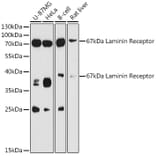 Western Blot - Anti-67kDa Laminin Receptor Antibody (A89623) - Antibodies.com