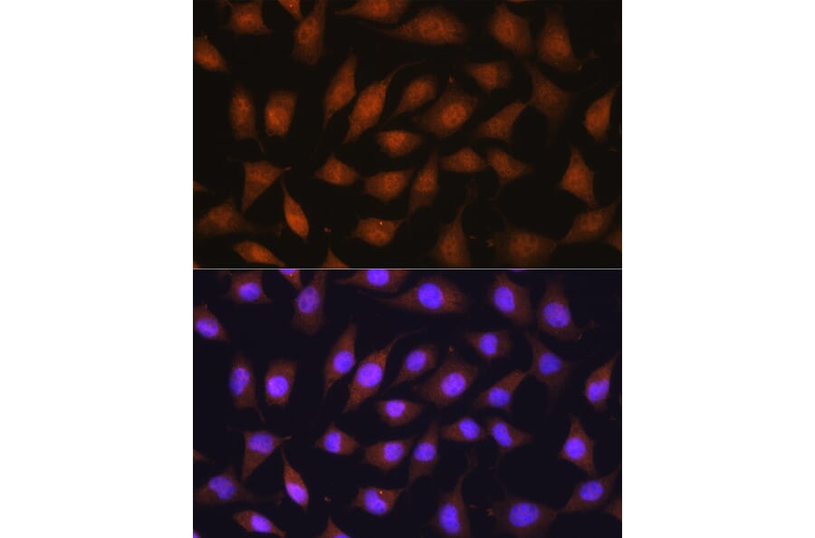 Immunofluorescence - Anti-67kDa Laminin Receptor Antibody (A89623) - Antibodies.com