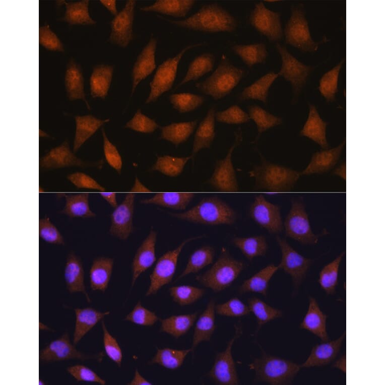 Immunofluorescence - Anti-67kDa Laminin Receptor Antibody (A89623) - Antibodies.com