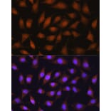Immunofluorescence - Anti-67kDa Laminin Receptor Antibody (A89623) - Antibodies.com