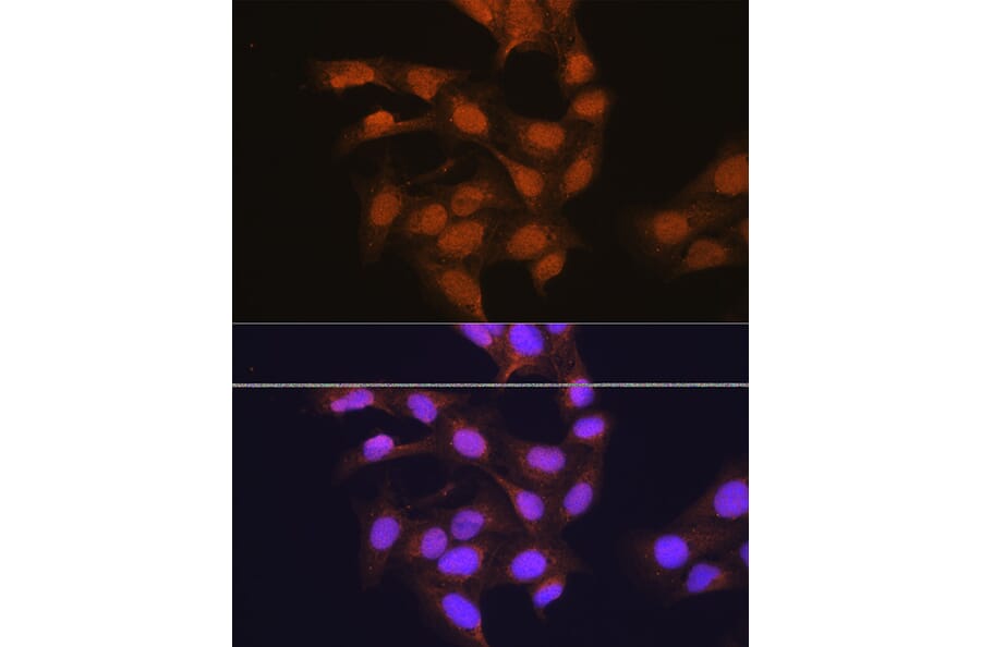 Immunofluorescence - Anti-67kDa Laminin Receptor Antibody (A89623) - Antibodies.com