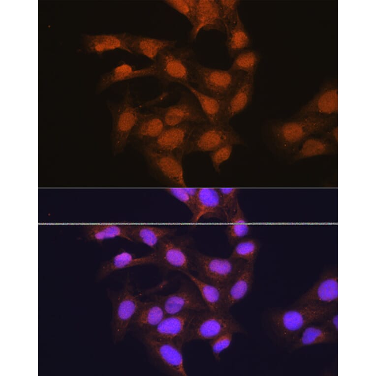 Immunofluorescence - Anti-67kDa Laminin Receptor Antibody (A89623) - Antibodies.com