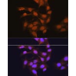 Immunofluorescence - Anti-67kDa Laminin Receptor Antibody (A89623) - Antibodies.com