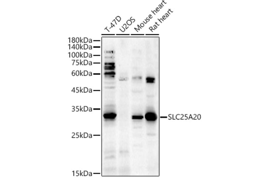 Western Blot - Anti-SLC25A20 Antibody (A89624) - Antibodies.com