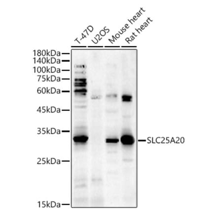 Western Blot - Anti-SLC25A20 Antibody (A89624) - Antibodies.com