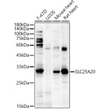 Western Blot - Anti-SLC25A20 Antibody (A89624) - Antibodies.com