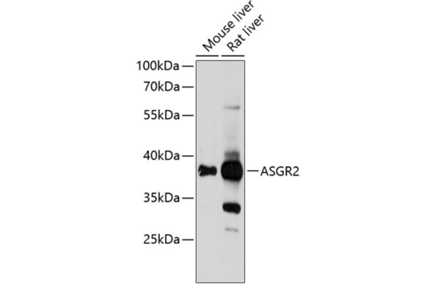 Western Blot - Anti-ASGR2 Antibody (A89626) - Antibodies.com