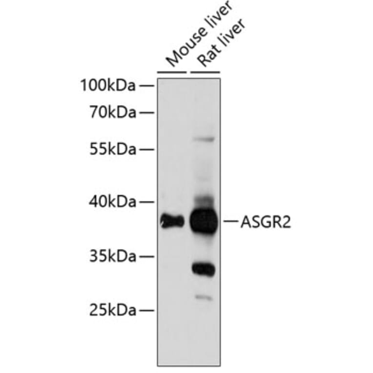 Western Blot - Anti-ASGR2 Antibody (A89626) - Antibodies.com