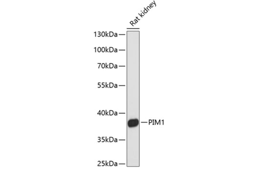 Western Blot - Anti-PIM1 Antibody (A89627) - Antibodies.com