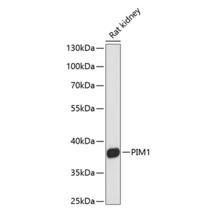 Western Blot - Anti-PIM1 Antibody (A89627) - Antibodies.com