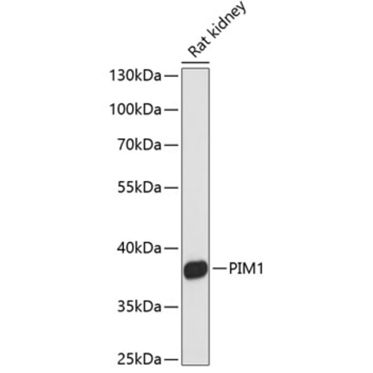 Western Blot - Anti-PIM1 Antibody (A89627) - Antibodies.com