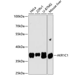 Western Blot - Anti-AKR1C1 Antibody (A89628) - Antibodies.com