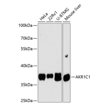 Western Blot - Anti-AKR1C1 Antibody (A89628) - Antibodies.com