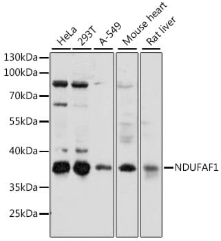 Western blot analysis of extracts of various cell lines, using Anti-NDUFAF1 Antibody (A15835) at 1:1,000 dilution.
Secondary antibody: Goat Anti-Rabbit IgG (H+L) (HRP) (AS014) at 1:10,000 dilution.
Lysates / proteins: 25µg per lane.
Blocking buffer: 3% non-fat dry milk in TBST.
Detection: ECL Basic Kit (RM00020).
Exposure time: 35s.